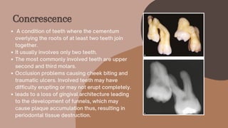 A condition of teeth where the cementum
overlying the roots of at least two teeth join
together.
It usually involves only two teeth.
The most commonly involved teeth are upper
second and third molars.
Occlusion problems causing cheek biting and
traumatic ulcers. Involved teeth may have
difficulty erupting or may not erupt completely.
leads to a loss of gingival architecture leading
to the development of funnels, which may
cause plaque accumulation thus, resulting in
periodontal tissue destruction.
Concrescence
 