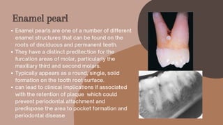 Enamel pearls are one of a number of different
enamel structures that can be found on the
roots of deciduous and permanent teeth.
They have a distinct predilection for the
furcation areas of molar, particularly the
maxillary third and second molars.
Typically appears as a round, single, solid
formation on the tooth root surface.
can lead to clinical implications if associated
with the retention of plaque which could
prevent periodontal attachment and
predispose the area to pocket formation and
periodontal disease
Enamel pearl
 