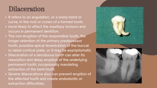 It refers to an angulation, or a sharp bend or
curve, in the root or crown of a formed tooth.
more likely to affect the maxillary incisors and
occurs in permanent dentition.
The non-eruption of the responsible tooth, the
longer retention of the primary predecessor
tooth, possible apical fenestration of the buccal
or labial cortical plate, or it may be asymptomatic
Dilaceration of a deciduous tooth can alter its
resorption and delay eruption of the underlying
permanent tooth, occasionally mandating
extraction of the bent tooth.
Severe dilacerations also can prevent eruption of
the affected tooth and create endodontic or
extraction difficulties.
Dilaceration
 
