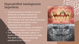 Hypocalcified Amelogenesis
Imperfecta
Characterized by enamel of normal
thickness on newly erupted and
unerupted and unresolved teeth.
The enamel is soft and may be lost soon
after eruption leaving the crown
composed only of dentin.
The enamel has a cheesy consistency
and can be scraped from the dentin.
The teeth may be white, yellow, or
brown, and the enamel may be rough.
The teeth may also be extremely
sensitive to hot and cold.
 