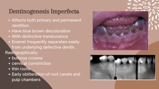 Dentinogenesis Imperfecta
Affects both primary and permanent
dentition.
Have blue brown discoloration
With distinctive translucence
Enamel frequently separates easily
from underlying defective dentin.
bulbous crowns
cervical constriction
thin roots
Early obliteration of root canals and
pulp chambers
Radiographically:
 