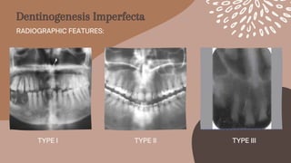 TYPE II


TYPE I TYPE III
Dentinogenesis Imperfecta
RADIOGRAPHIC FEATURES:
 