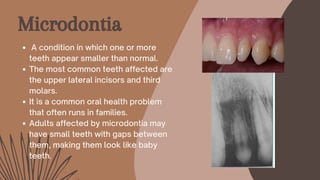 Microdontia
A condition in which one or more
teeth appear smaller than normal.
The most common teeth affected are
the upper lateral incisors and third
molars.
It is a common oral health problem
that often runs in families.
Adults affected by microdontia may
have small teeth with gaps between
them, making them look like baby
teeth.
 