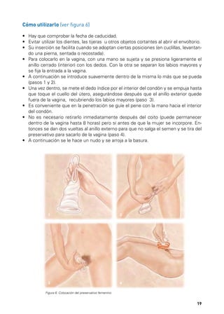 Cómo utilizarlo (ver figura 6)
•	 Hay que comprobar la fecha de caducidad.
•	  vitar utilizar los dientes, las tijeras  u otros objetos cortantes al abrir el envoltorio.
E
•	  u inserción se facilita cuando se adoptan ciertas posiciones (en cuclillas, levantanS
do una pierna, sentada o recostada).
•	  ara colocarlo en la vagina, con una mano se sujeta y se presiona ligeramente el
P
anillo cerrado (interior) con los dedos. Con la otra se separan los labios mayores y
se fija la entrada a la vagina.
•	  continuación se introduce suavemente dentro de la misma lo más que se pueda
A
(pasos 1 y 2).
• U
 	  na vez dentro, se mete el dedo índice por el interior del condón y se empuja hasta
que toque el cuello del útero, asegurándose después que el anillo exterior quede
fuera de la vagina, recubriendo los labios mayores (paso 3).
•	  s conveniente que en la penetración se guíe el pene con la mano hacia el interior
E
del condón.
• N
 	  o es necesario retirarlo inmediatamente después del coito (puede permanecer
dentro de la vagina hasta 8 horas) pero sí antes de que la mujer se incorpore. Entonces se dan dos vueltas al anillo externo para que no salga el semen y se tira del
preservativo para sacarlo de la vagina (paso 4).
•	  continuación se le hace un nudo y se arroja a la basura.
A

1

2

3

4

Figura 6. Colocación del preservativo femenino.

19

 