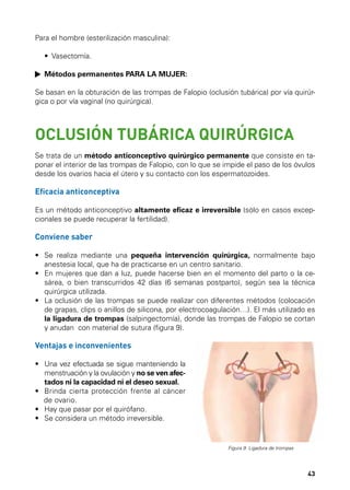 Para el hombre (esterilización masculina):
	 •  Vasectomía.
	 Métodos permanentes PARA LA MUJER:
Se basan en la obturación de las trompas de Falopio (oclusión tubárica) por vía quirúrgica o por vía vaginal (no quirúrgica).

OCLUSIÓN TUBÁRICA QUIRÚRGICA
Se trata de un método anticonceptivo quirúrgico permanente que consiste en taponar el interior de las trompas de Falopio, con lo que se impide el paso de los óvulos
desde los ovarios hacia el útero y su contacto con los espermatozoides.

Eficacia anticonceptiva
Es un método anticonceptivo altamente eficaz e irreversible (sólo en casos excepcionales se puede recuperar la fertilidad).

Conviene saber
•	  e realiza mediante una pequeña intervención quirúrgica, normalmente bajo
S
anestesia local, que ha de practicarse en un centro sanitario.
•	  n mujeres que dan a luz, puede hacerse bien en el momento del parto o la ceE
sárea, o bien transcurridos 42 días (6 semanas postparto), según sea la técnica
quirúrgica utilizada.
•	  a oclusión de las trompas se puede realizar con diferentes métodos (colocación
L
de grapas, clips o anillos de silicona, por electrocoagulación…). El más utilizado es
la ligadura de trompas (salpingectomía), donde las trompas de Falopio se cortan
y anudan con material de sutura (figura 9).

Ventajas e inconvenientes
•	  na vez efectuada se sigue manteniendo la
U
menstruación y la ovulación y no se ven afectados ni la capacidad ni el deseo sexual.
•	 Brinda cierta protección frente al cáncer
de ovario.
•	 Hay que pasar por el quirófano.
•	 Se considera un método irreversible.

Figura 9. Ligadura de trompas

43

 