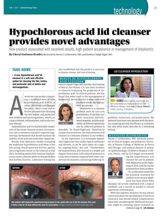 A
novel eye-care product contain-
ing a stabilized form of pure
hypochlorous acid (0.01%) in
saline(Advancedi-LidCleanser,
NovaBay) offers a safe and ef-
fective alternative for cleansing
the lids, lashes, and periocular
skin of debris and microorganisms, which can
cause irritation, inflammation, and ocular sur-
face disease.
Hypochlorous acid is a bactericidal compo-
nent of the innate immune system. Incorpora-
tion into a commercial product required engi-
neering a formulation that would maintain the
stability of the acid and avoid other impurities.
Results from laboratory studies evaluating
the stabilized hypochlorous acid show it has
fast-acting, broad-spectrum activity against
microorganisms found in the external ocular
flora, including methicillin-resistant Staphylo-
coccus aureus, plus the ability to disrupt biofilm
that harbors bacteria. Laboratory testing has
also established that the product is non-toxic
to human tissues and non-irritating.
M e r i t s o f h y p o c h l o r o u s
a c i d c l e a n s e r
KathrynNajafi-Tagol,MD,founder,EyeInstitute
of Marin, San Rafael, CA, has been involved
in research evaluating the properties of hy-
pochlorous acid. In clinical practice, she has
found that when used in the management of
blepharitis, the lid cleanser is associated with
excellent results and high pa-
tient acceptance.
“Blepharitis is a common
problem seen by eye-care
practitioners. It can have cos-
metic, structural, and func-
tionalsequelae,andtheavail-
ability of different options for
use by affected patients is
desirable,” Dr. Najafi-Tagol said. “Based on its
unique characteristics, the hypochlorous acid
cleanser is a welcome addition to our toolbox.
“In my experience, it is extremely helpful,
and I appreciate that unlike topical antibiotics
and steroids, it can be used safely on a regu-
lar, ongoing basis,” she said. “Furthermore,
the hypochlorous acid cleanser is a simple and
elegant formulation with reduced potential to
cause skin irritation compared with other com-
mercial lid cleansers containing buffering in-
gredients, surfactants, and preservatives. My
patients have been very pleased with the prod-
uct, enjoying not only its efficacy as a cleanser
but also what many describe as a refreshing
feeling.”
M a n a g i n g b l e p h a r i t i s
Steven J. Lichtenstein, MD, associate profes-
sor of clinical surgery and pediatrics, Univer-
sity of Illinois College of Medicine at Peoria
and Chicago, and medical director of pediat-
ric ophthalmology, Children's Hospital of Illi-
nois, Peoria, said he first began recommend-
ing the hypochlorous acid
cleanser for use by patients
with blepharitis at the begin-
ning of 2014, and the results
achievedhavebeenexcellent.
Dr. Lichtenstein noted that
his standard treatment for
children with chronic bleph-
aritis has been dilute baby
shampoo lid scrubs combined with a topical
antibiotic and a steroid as needed to control
significant inflammation.
With this regimen, however, he was always
concerned about the development of bacterial
resistance and steroid-related complications,
especially considering the likelihood that par-
ents might be initiating repeat treatment on
Hypochlorous acid lid cleanser
provides novel advantages
New product associated with excellent results, high patient acceptance in management of blepharitis
By Cheryl Guttman Krader; Reviewed by Steven J. Lichtenstein, MD, and Kathryn Najafi-Tagol, MD
A new hypochlorous acid lid
cleanser is a safe and effective
option for cleaning the lids, lashes,
and periocular skin of debris and
microorganisms.
Take-Home
Dr.Najafi-Tagol
Dr.Lichtenstein
This patient with blepharitis experienced improvement to the eyelid with use of the lid cleanser. She used
it twice a day for 10 days without the need for prescription. (Images courtesy of Kathryn Najafi-Tagol, MD)
VIDEO Watch Kathryn Najafi-Tagol, MD,
and patients discuss the lid cleanser and the
difference it makes. Go to http://bit.ly/1hhtwri.
(Video courtesy of NovaBay)
lid cleanser introduction
Before After
29June 1, 2014 :: Ophthalmology Times
technologytechnology
Continues on page 30 : Lid cleanser
 