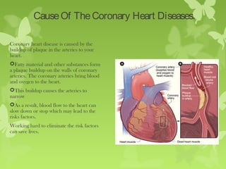 (Prevention And Control Of Coronary Heart Diseases | PPT