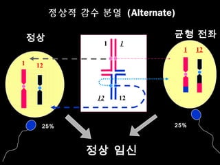 정상적 감수 분열 (Alternate)
정상
1

1

1

균형 전좌
1

12

12

12

25%

25%

정상 임신

12

 