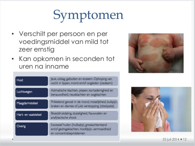 KK Voedselallergieën, 25 juli 2014 online versie