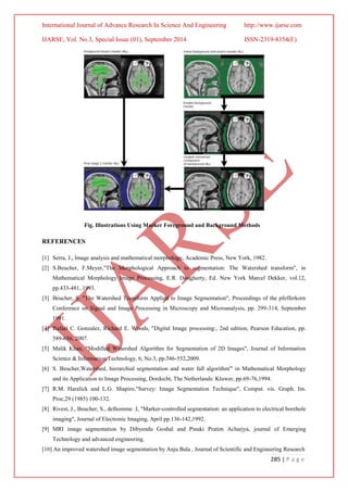 International Journal of Advance Research In Science And Engineering http://www.ijarse.com
IJARSE, Vol. No.3, Special Issue (01), September 2014 ISSN-2319-8354(E)
285 | P a g e
Fig. Illustrations Using Marker Foreground and Background Methods
REFERENCES
[1] Serra, J., Image analysis and mathematical morphology, Academic Press, New York, 1982.
[2] S.Beucher, F.Meyer,"The Morphological Approach to segmentation: The Watershed transform", in
Mathematical Morphology Image Processing, E.R. Dougherty, Ed. New York Marcel Dekker, vol.12,
pp.433-481, 1993.
[3] Beucher, S. "The Watershed Transform Applied to Image Segmentation", Proceedings of the pfefferkorn
Conference on Signal and Image Processing in Microscopy and Microanalysis, pp. 299-314, September
1991.
[4] Rafael C. Gonzalez, Richard E. Woods, "Digital Image processing:, 2nd edition, Pearson Education, pp.
589-656, 2007.
[5] Malik Khan, "Modified Watershed Algorithm for Segmentation of 2D Images", Journal of Information
Science & Information Technology, 6, No.3, pp.546-552,2009.
[6] S. Beucher,Watershed, hierarchial segmentation and water fall algorithm"' in Mathematical Morphology
and its Application to Image Processing, Dordecht, The Netherlands: Kluwer, pp.69-76,1994.
[7] R.M. Haralick and L.G. Shapiro,"Survey: Image Segmentation Technique", Comput. vis. Graph. Im.
Proc,29 (1985) 100-132.
[8] Rivest, J., Beucher, S., delhomme. J, "Marker-controlled segmentation: an application to electrical borehole
imaging", Journal of Electronic Imaging, April pp.136-142,1992.
[9] MRI image segmentation by Dibyendu Goshal and Pinaki Pratim Acharjya, journal of Emerging
Technology and advanced engineering.
[10] An improved watershed image segmentation by Anju Bala , Journal of Scientific and Engineering Research
 