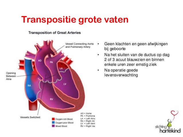 Presentatie Hartekind 2015 presentatie-hartekind-2015