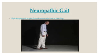 Neuropathic Gait
◦ High stepping gait to gain floor clearance often due to foot drop
 