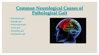 Common Neurological Causes of
Pathological Gait
◦ Hemiplegic gait
◦ Diplegic gait
◦ Parkinsonian gait
◦ Ataxic gait
◦ Myopathic gait
◦ Neuropathic gait
 
