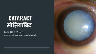 CATARACT
मो तया बंद
By SUJIT KUMAR
saraswati-eye-care.business.site
 