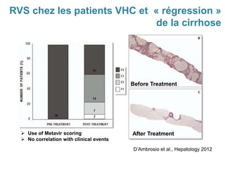 Before Treatment
After Treatment
D’Ambrosio et al., Hepatology 2012
 Use of Metavir scoring
 No correlation with clinical events
RVS chez les patients VHC et « régression »
de la cirrhose
 