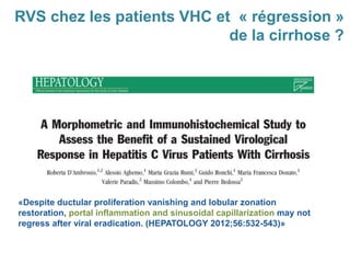 «Despite ductular proliferation vanishing and lobular zonation
restoration, portal inflammation and sinusoidal capillarization may not
regress after viral eradication. (HEPATOLOGY 2012;56:532-543)»
RVS chez les patients VHC et « régression »
de la cirrhose ?
 