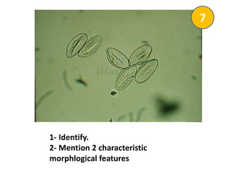 1- Identify.
2- Mention 2 characteristic
morphlogical features
7
 