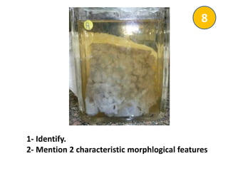 1- Identify.
2- Mention 2 characteristic morphlogical features
8
 