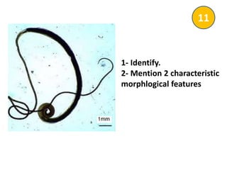 1- Identify.
2- Mention 2 characteristic
morphlogical features
11
 