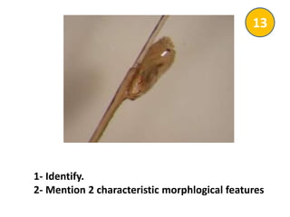 1- Identify.
2- Mention 2 characteristic morphlogical features
13
 