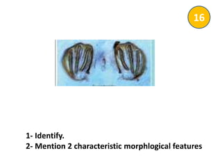 1- Identify.
2- Mention 2 characteristic morphlogical features
16
 
