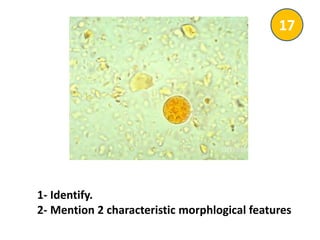 1- Identify.
2- Mention 2 characteristic morphlogical features
17
 
