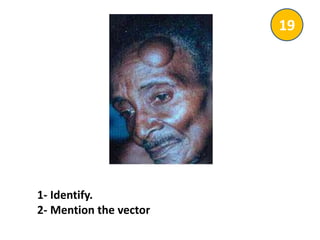 1- Identify.
2- Mention the vector
19
 