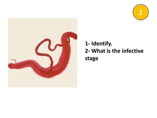 1- Identify.
2- What is the infective
stage
1
 