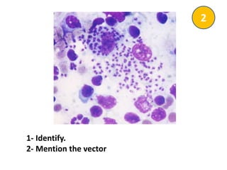 1- Identify.
2- Mention the vector
2
 