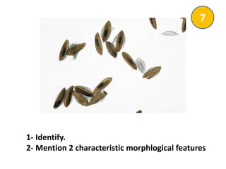 1- Identify.
2- Mention 2 characteristic morphlogical features
7
 