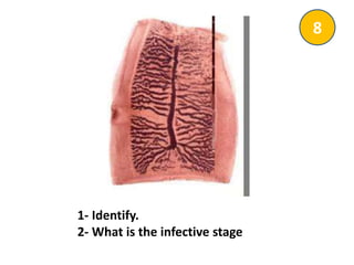 1- Identify.
2- What is the infective stage
8
 