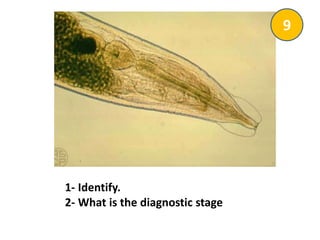1- Identify.
2- What is the diagnostic stage
9
 