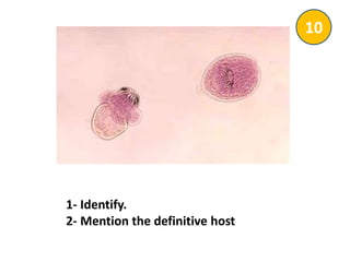 1- Identify.
2- Mention the definitive host
10
 