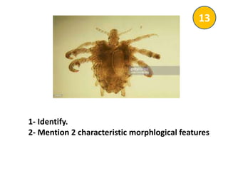 1- Identify.
2- Mention 2 characteristic morphlogical features
13
 
