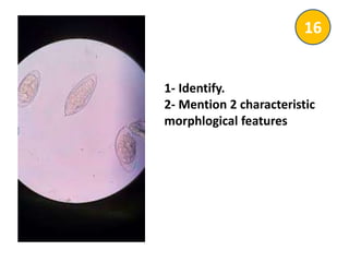 1- Identify.
2- Mention 2 characteristic
morphlogical features
16
 