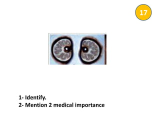 1- Identify.
2- Mention 2 medical importance
17
 