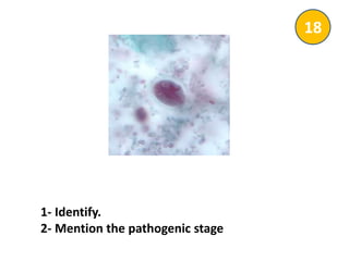 1- Identify.
2- Mention the pathogenic stage
18
 
