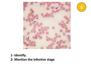 1- Identify.
2- Mention the infective stage
6
 