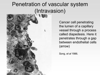 Penetration of vascular system
(Intravasion)
Cancer cell penetrating
the lumen of a capillary
vessel through a process
called diapedesis. Here it
penetrates through a gap
between endothelial cells
(arrow)
Song, et al 1986.
 