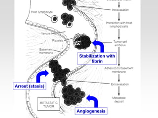 Stabilization with
fibrin
Arrest (stasis)
Angiogenesis
 