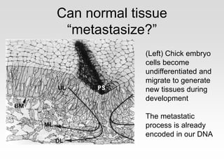 Can normal tissue
“metastasize?”
(Left) Chick embryo
cells become
undifferentiated and
migrate to generate
new tissues during
development
The metastatic
process is already
encoded in our DNA
 