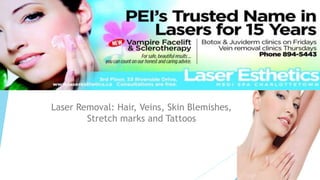 Laser Removal: Hair, Veins, Skin Blemishes,
Stretch marks and Tattoos
 