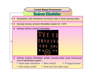 Individu sindrom Klinefelter adalah seorang lelaki yang mempunyai
ciri-ciri kewanitaan seperti :-
Contoh Mutasi Kromososm
Disebabkan oleh berlebihan kromosom seks X pada seorang lelaki.
Genotip individu sindrom Klinefelter adalah 44 + XXY
Kariotip individu sindrom Klinefelter
 Buah dada membesar  Bahu sempit  Punggung besar
 Bulu badan sedikit  testis kecil dan tidak subur
 