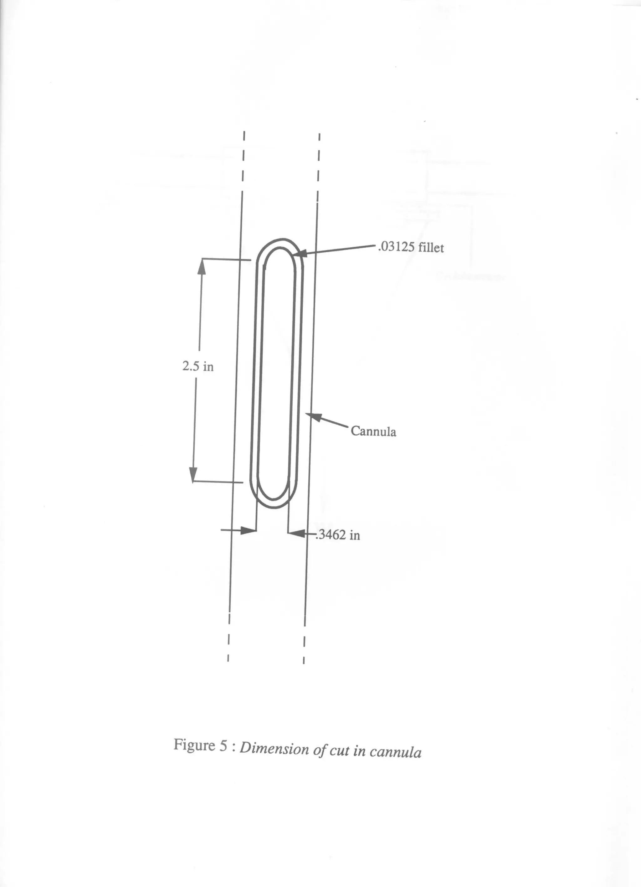 Device to Allow Alternative Method of Retrograde Cardioplegia Injection