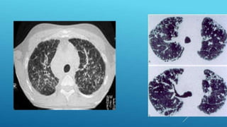 F5415d2ccaee88c362ddb53551e8fd99