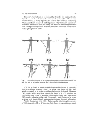 4.2 The Electrocardiogram 95
The heart’s electrical activity is measured by electrodes that are placed on the
skin. The amplitudes, polarities and also times and duration of the different com-
ponents of the ECG mainly depend on the location of the electrodes on the body.
When electrodes are placed with medical purposes (4.1), the standard locations are
on both the arms near the wrists, the left leg near the ankle, and several points of the
chest called precordial positions. Moreover, a reference electrode is usually placed
on the right leg near the ankle.
Fig. 4.1 The standard leads (top) and the augmented leads (bottom) reﬂect the limb electrodes (left
arm, right arm, left leg) used to record the heart’s electrical axis in the frontal plane.
ECG can be viewed as pseudo periodical signals, characterized by elementary
beats in the speciﬁc waveform PQRST. The cardiac cycle begins with the P wave
which corresponds to the period of atrial depolarization in the heart. It follows the
QRS complex, which is the most recognizable feature of an ECG waveform and
corresponds to the period of ventricular repolarization. The T wave succeeds the
QRS complex ending the cardiac cycle. Occasionally a small U wave can be present
at the end of the signal, although not containing signiﬁcant diagnostic information.
Another characteristic of the ECG is the interval, that is the timing between pairs
of ECG features (i.e. RR or ST intervals). Such feature is of great interest since it
 