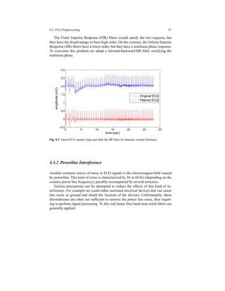 4.3 ECG Preprocessing 97
The Finite Impulse Response (FIR) ﬁlters would satisfy the two requests, but
they have the disadvantage to have high order. On the contrary, the Inﬁnite Impulse
Response (IIR) ﬁlters have a lower order, but they have a nonlinear phase response.
To overcame this problem we adopt a forward-backward IIR ﬁlter, rectifying the
nonlinear phase.
0 5 10 15 20 25 30
−0.5
0
0.5
1
1.5
2.0
2.5
3.0
time (sec)
amplitude(mV)
Original ECG
Filtered ECG
Fig. 4.3 Initial ECG sample (top) and after the IIR ﬁlter for baseline wander (bottom).
4.3.2 Powerline Interference
Another common source of noise in ECG signals is the electromagnet ﬁeld caused
by powerline. This kind of noise is characterized by 50 or 60 Hz (depending on the
country power line frequency), possibly accompanied by several armonics.
Various precautions can be attempted to reduce the effects of this kind of in-
terference. For example we could either surround electrical devices that can cause
line noise or ground and shield the location of the devices. Unfortunately, these
shrewdnesses are often not sufﬁcient to remove the power line noise, thus requir-
ing to perform signal processing. To this end linear time band stop notch ﬁlters are
generally applied.
 