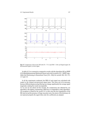 4.8 Experimental Results 107
0 1 2 3 4 5
900
1000
1100
1200
(b)
0 1 2 3 4 5
−150
−100
−50
0
50
100
150
(c)
0 1 2 3 4 5
900
1000
1100
1200
(a)
Fig. 4.7 Compression of the record 100 with CR = 75.12 and PRD = 0.68. (a) Original signal. (b)
Reconstructed signal. (c) Error signal.
In table (4.3) we summarize comparative results with the algorithms DCeq-MMP
[52] (Multididimensional Multiscale Parser) and with Foveation [33] + SPIHT algo-
rithm (Set Partitioning in Hierarchical Trees [101, 106]) for records 100, 102, 115,
117 and 119.
In all the experiments conducted, the PRD of each signal was calculated with
respect to the original non-processed signal mean. This turns out to be necessary
because different preprocessing ﬁltering can change signiﬁcantly the average signal
magnitude, making the results incomparable.
As we can see for almost all the records, the compression rate obtained by our
algorithm is the highest, maintaining a PRD less or comparable to other algorithms.
An exception is found for the record 119: in this case this the irregularities of the
RR interval and the presence of large muscular noise, the atoms of the dictionary do
not represent properly the signal when only few coefﬁcients are adopted.
 