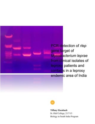 Tiffany Eisenbach
St. Olaf College, 2/17/15
Biology in South India Program
By
PCR detection of rlep
gene target of
Mycobacterium leprae
from clinical isolates of
leprosy patients and
contacts in a leprosy
endemic area of India
 