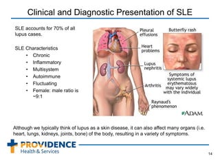Clinical and Diagnostic Presentation of SLE
SLE accounts for 70% of all
lupus cases.
SLE Characteristics
• Chronic
• Inflammatory
• Multisystem
• Autoimmune
• Fluctuating
• Female: male ratio is
~9:1
14
Although we typically think of lupus as a skin disease, it can also affect many organs (i.e.
heart, lungs, kidneys, joints, bone) of the body, resulting in a variety of symptoms.
 